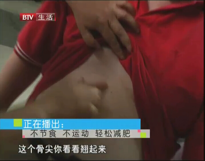 BTV《晚间新闻报道》 468斤“中国第一胖”20天减重60